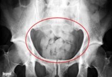 Банда набирала „гълтачи“ на кокаин от Доминикана за България кокаин