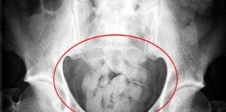 Банда набирала „гълтачи“ на кокаин от Доминикана за България кокаин