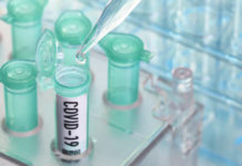 27 новозаразени с ковид през последното денонощие, няма починали