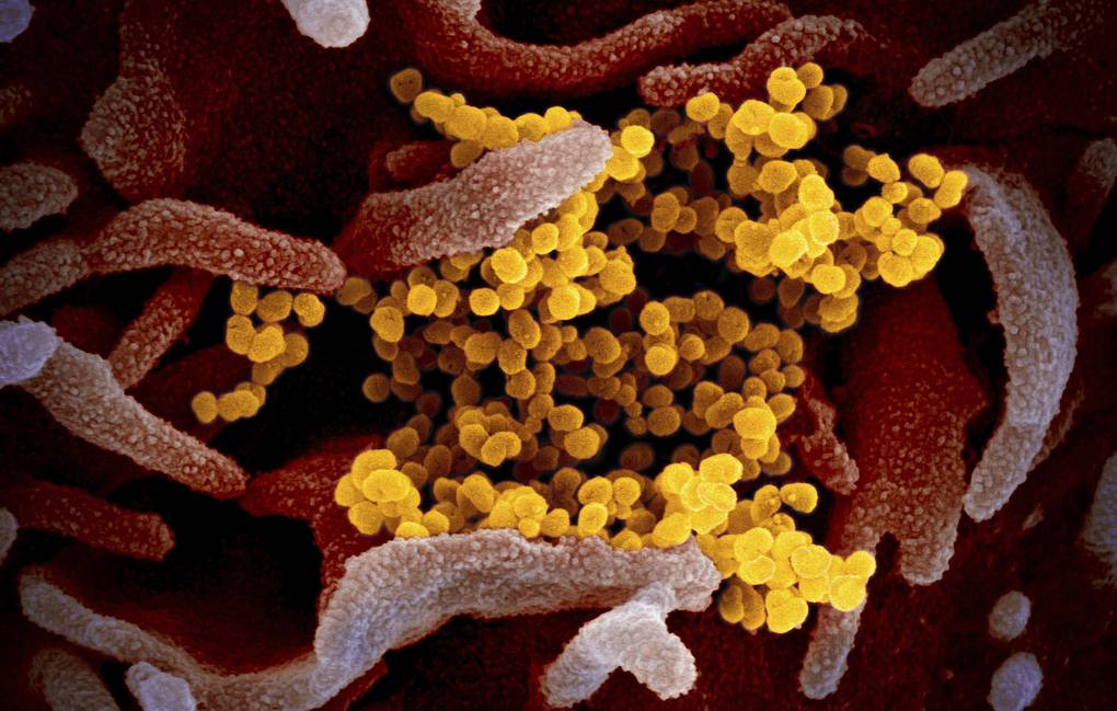 2602 нови заразени с коронавирус са били регистрирани през последното
