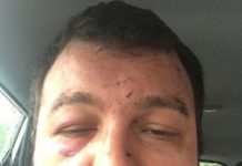 Англичани, бял и черен, пребиха зверски българин таксиджия в Норич /видео/