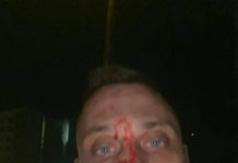 Битият Георги Флоров успял да свали часовника на единия от нападателите