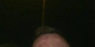 Битият Георги Флоров успял да свали часовника на единия от нападателите