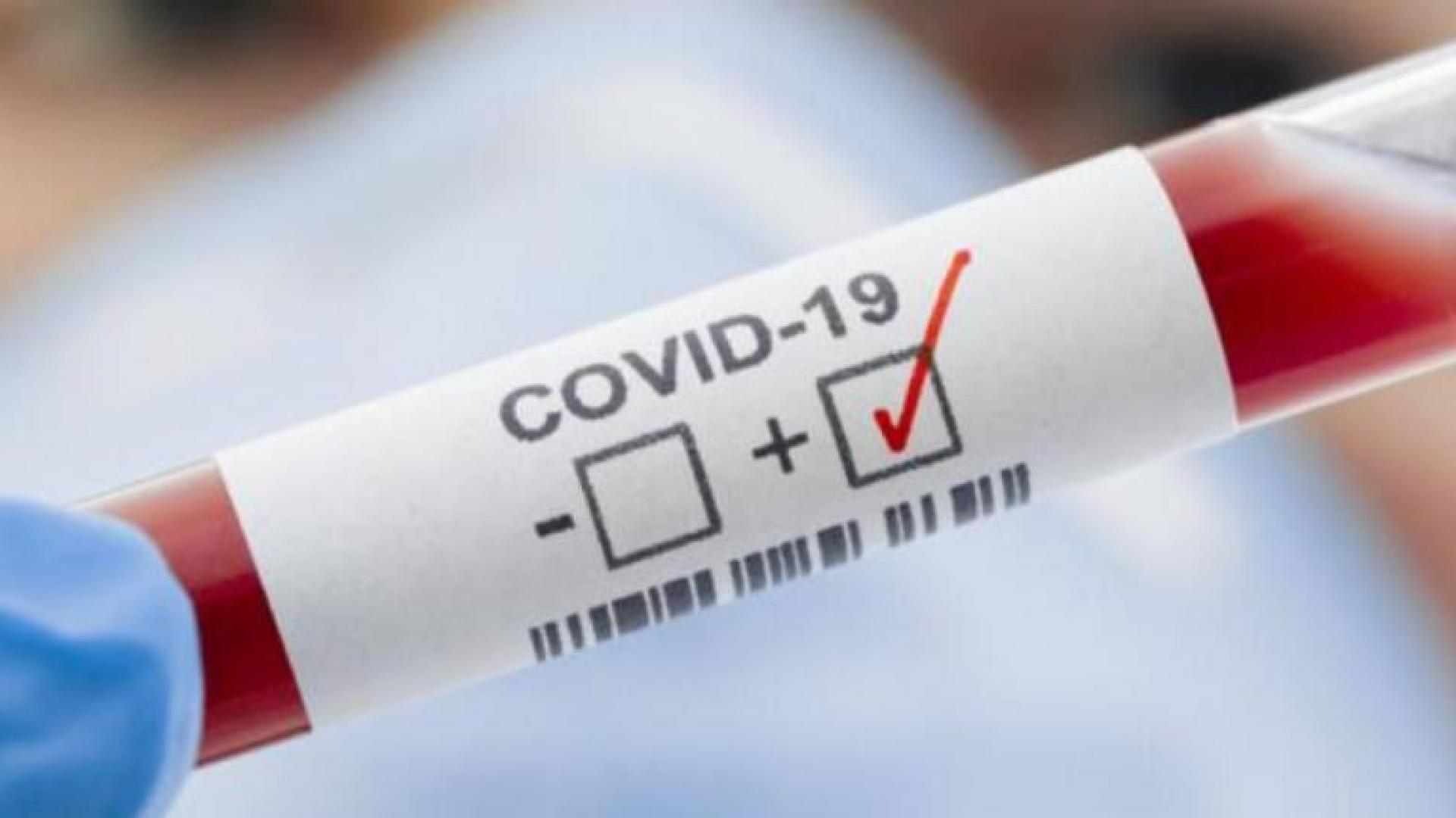 Регистрираните случаи на заразяване с коронавирус за изминалото денонощие са