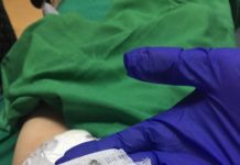 Лекари извадиха ключодържател от хранопровода на 2-годишно дете