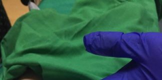 Лекари извадиха ключодържател от хранопровода на 2-годишно дете