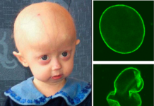 10-годишно момиче в Украйна умря от старост