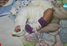 Приеха в болница новородено с жълтеница, изписаха го със счупен крак