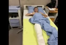 14-годишно момче е със счупена тазобедрена става след нападение от група пред мол