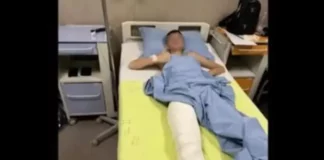 14-годишно момче е със счупена тазобедрена става след нападение от група пред мол