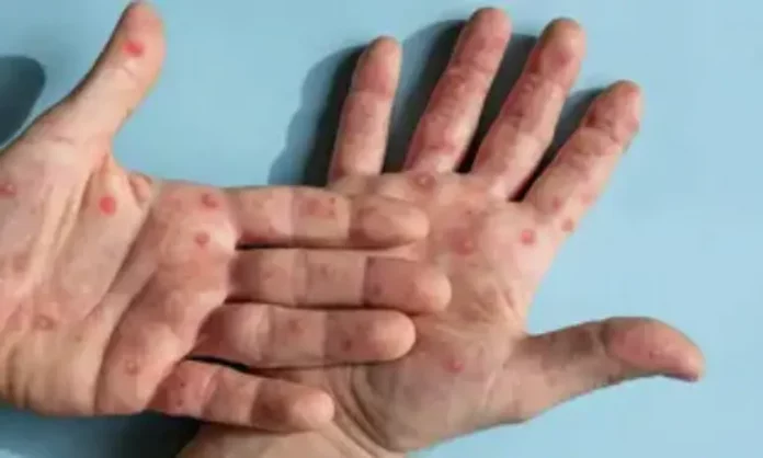 articles__faf5983381af7ebcfdffa148940932ab