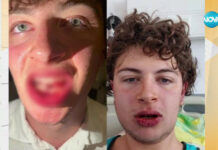 Заради парче пица студент е жестоко пребит от охранител в заведение на плажа