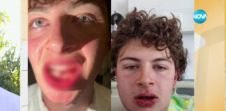 Заради парче пица студент е жестоко пребит от охранител в заведение на плажа