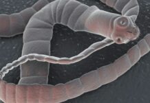 Първи случай за годината на заразен с кучешка тения у нас