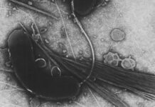 Болен от холера у нас, заразеният мъж е от Индия