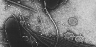 Болен от холера у нас, заразеният мъж е от Индия