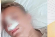 След размяна на реплики три момчета са пребити в Айтос