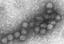 15 души са заразени със западнонилска треска в София през септември